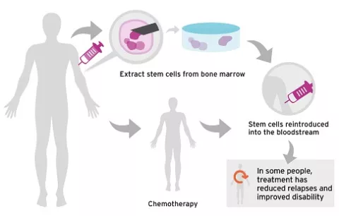 Diagram of stem cell treatment