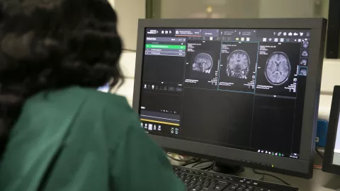 A computer screen showing a brain MRI