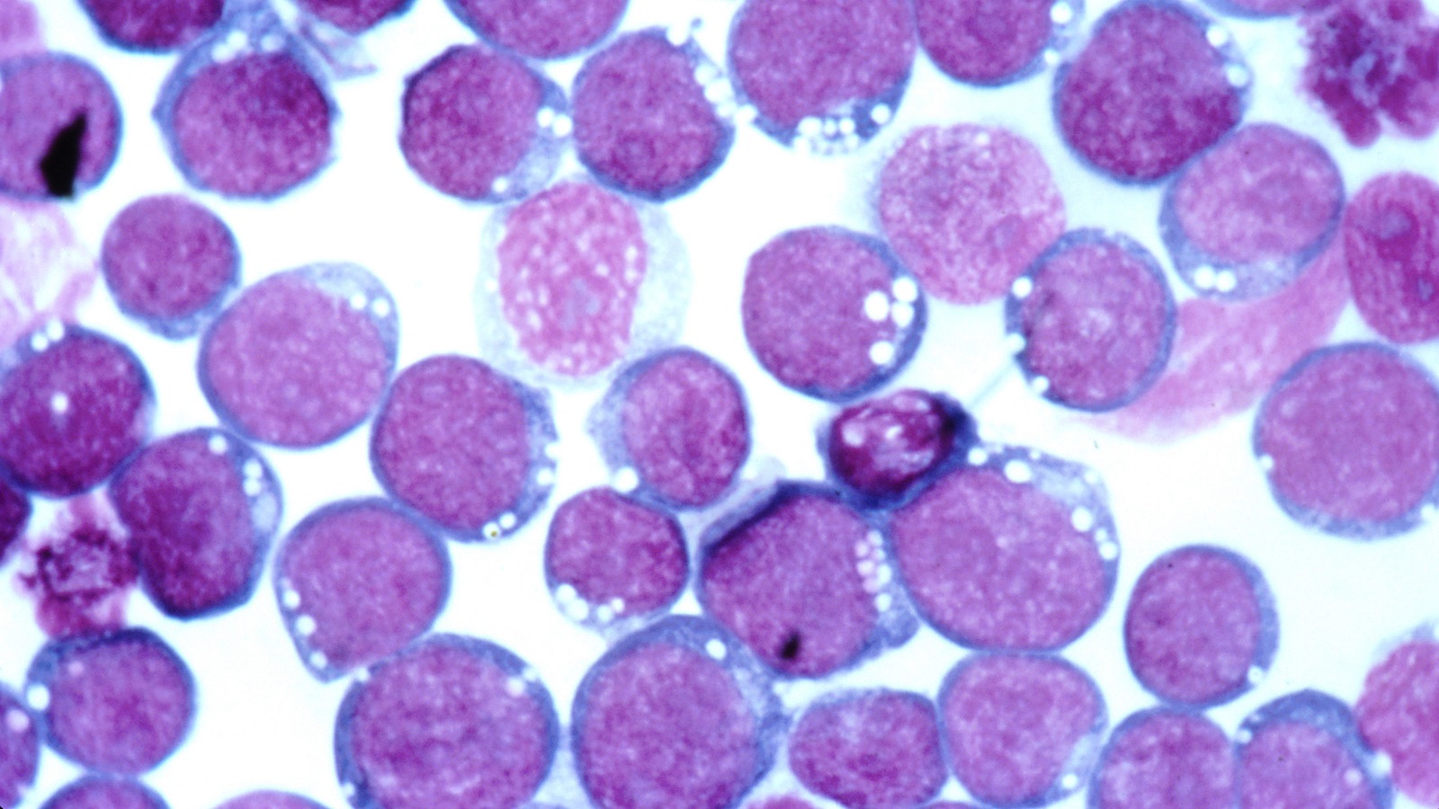 Epstein-Barr virus