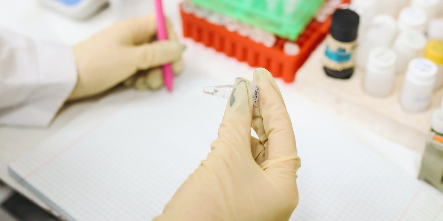 two hands in latex gloves holding a test tube and writing in a book