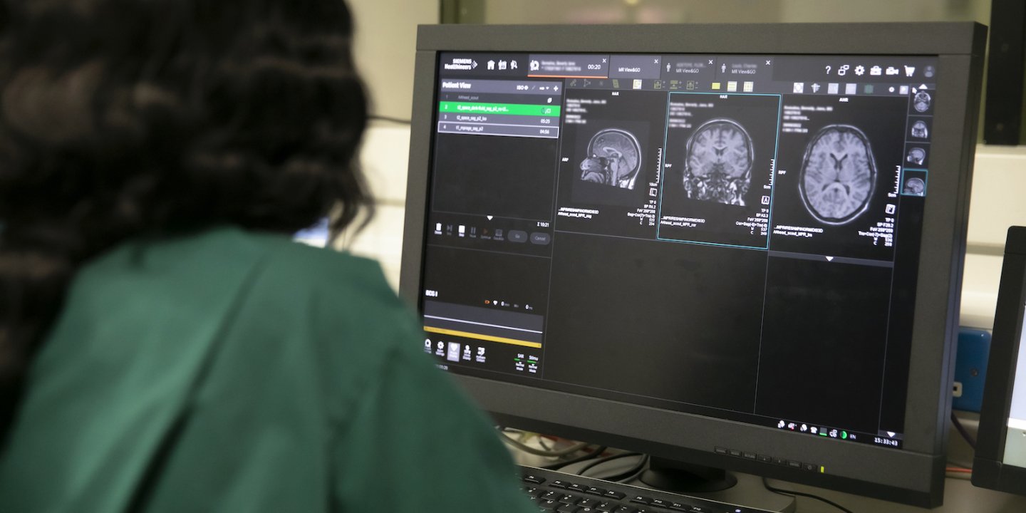 A computer screen showing a brain MRI