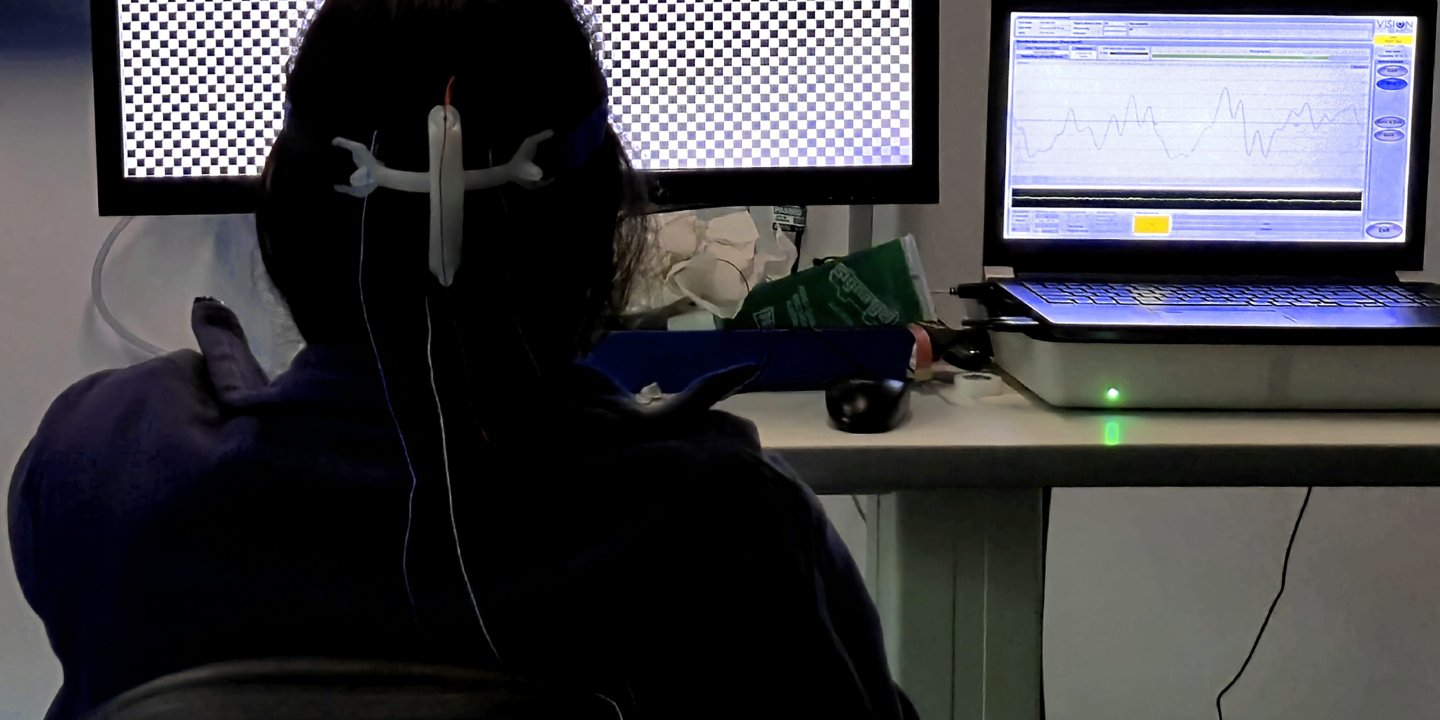 Visually Evoked Potential (VEP) test