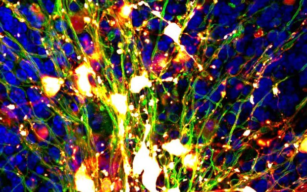 Close up of myelin producing cells dyed red and nerve fibres dyed green on a blue mouse brain background