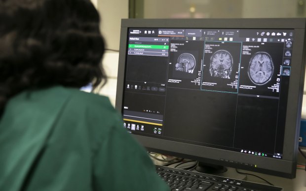 A computer screen showing a brain MRI