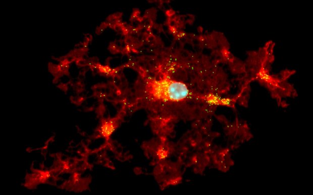 Image shows an oligodendrocyte (a myelin-making cell)