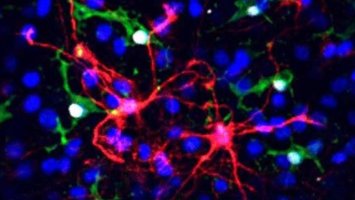 Photo: Inflammation and stem cells
