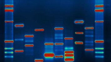 Image shows DNA bands on a gel