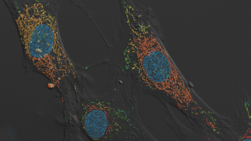 Picture of highly magnified nerve cells
