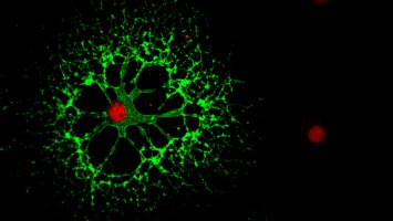 Oligodendrocyte