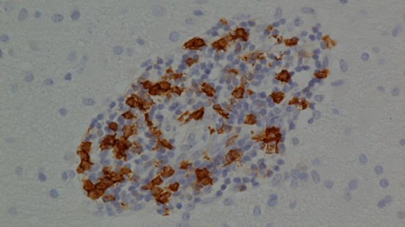 B cells