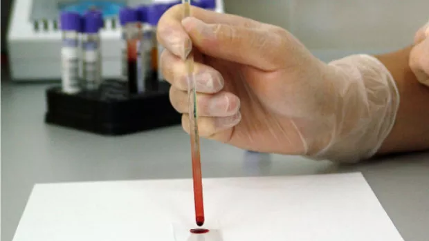 Hand wearing perspex glove testing a dropper of blood