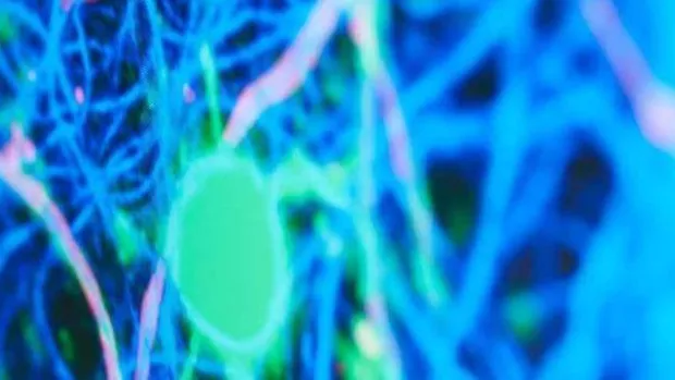 Photo: Immuno fluorescence at the Edinburgh lab 