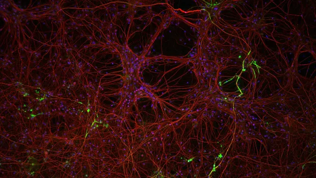 Image shows neuroprotection cells