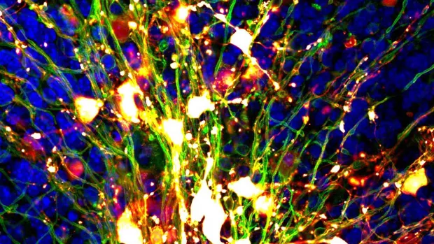 Close up of myelin producing cells dyed red and nerve fibres dyed green on a blue mouse brain background