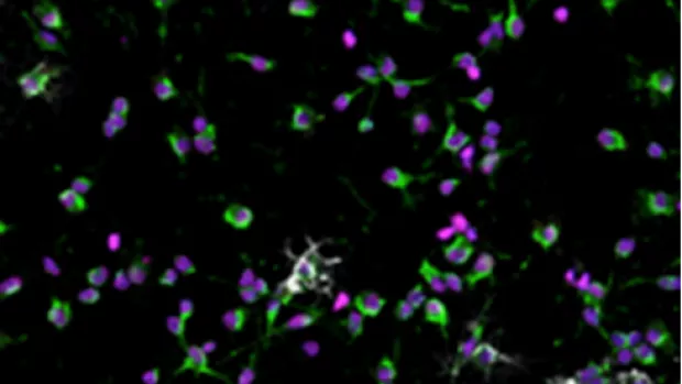 Image shows myelin making cells