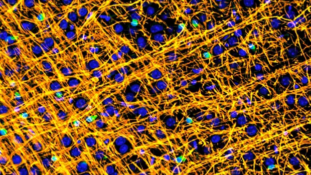 Image of a mouse brain showing myelin (gold) running through the brain