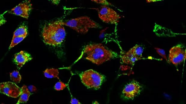 Microglia cells