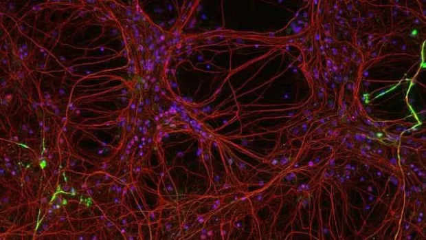 Photo: Close up of neuroprotection