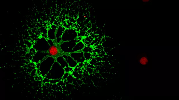 Oligodendrocyte