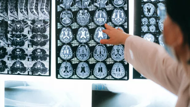 A doctor points to images of a brain and spine that are shown on MRI scans