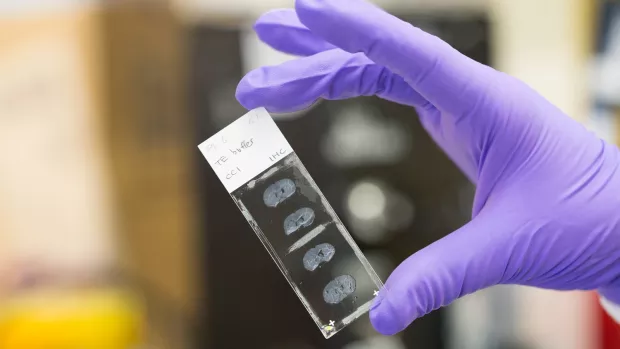 A researcher holds up a glass slide with some tissue on