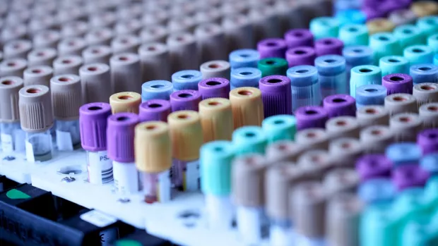 Photo of blood test tubes in a tray