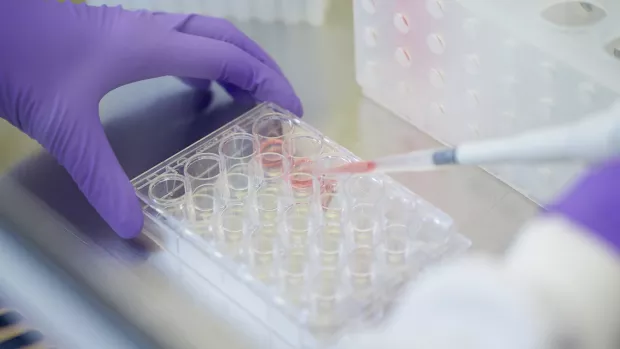 Close up of a person in purple gloves using a pipette 