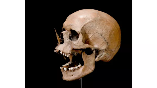 neolithic man skull used in ancient human research image