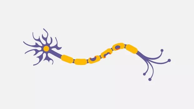 Nerve - with damaged myelin sheath