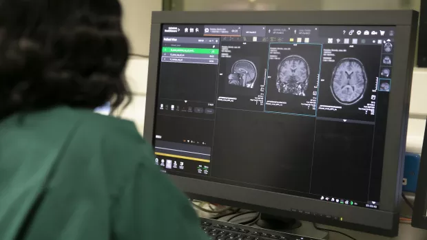 The history of MS research | MS Society