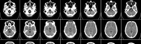 a black and white image of Brain scans