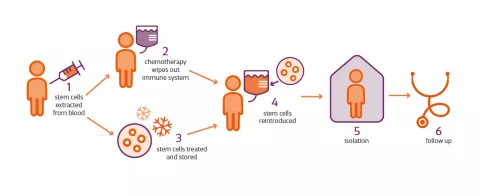 infographic shows HSCT stages, how stem cells are extracted and reintroduced after chemotheraphy is used to wipe out the immune system