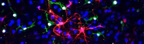 Photo: Inflammation and stem cells