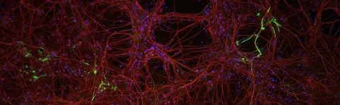Photo: Close up of neuroprotection