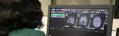 A computer monitor displaying three images from a brain MRI scan. To the left is the shoulder and back of the head of a radiologist who's looking at the screen