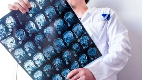 A researcher holding an MRI scan