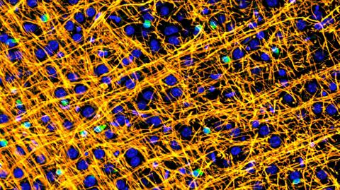 Image of a mouse brain showing myelin (gold) running through the brain