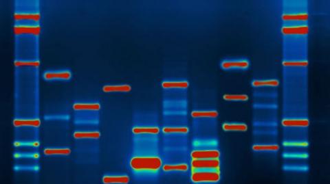 Image shows DNA bands on a gel