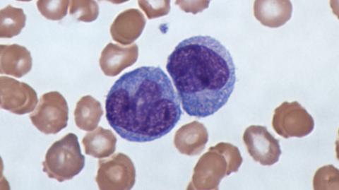 Picture shows several immune cells include monocytes