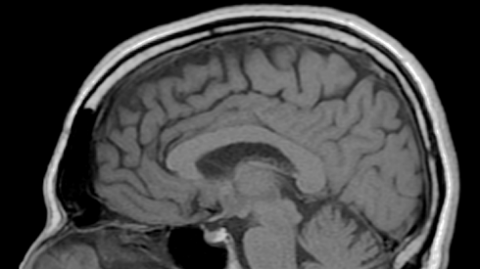 Cross section of human brain