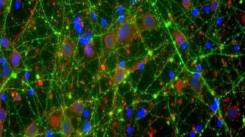 image shows nerve cell fibres