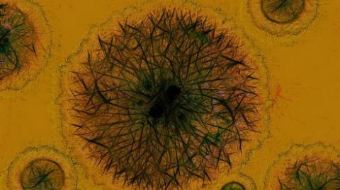 Image of a virus under the microscope. The virus is blue and red and there is a yellow background.